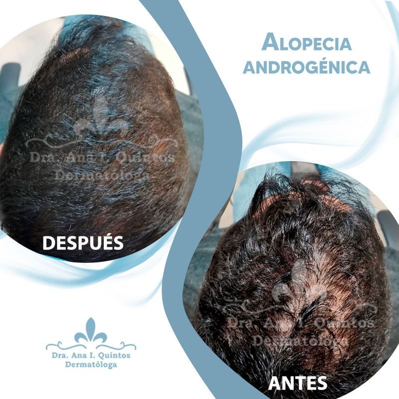 Dra. Ana Quintos - DERMATOLOGA