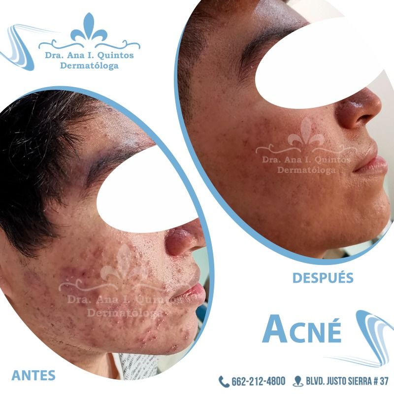 Dra. Ana Quintos - DERMATOLOGA