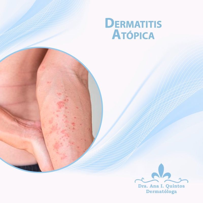 Dra. Ana Quintos - DERMATOLOGA