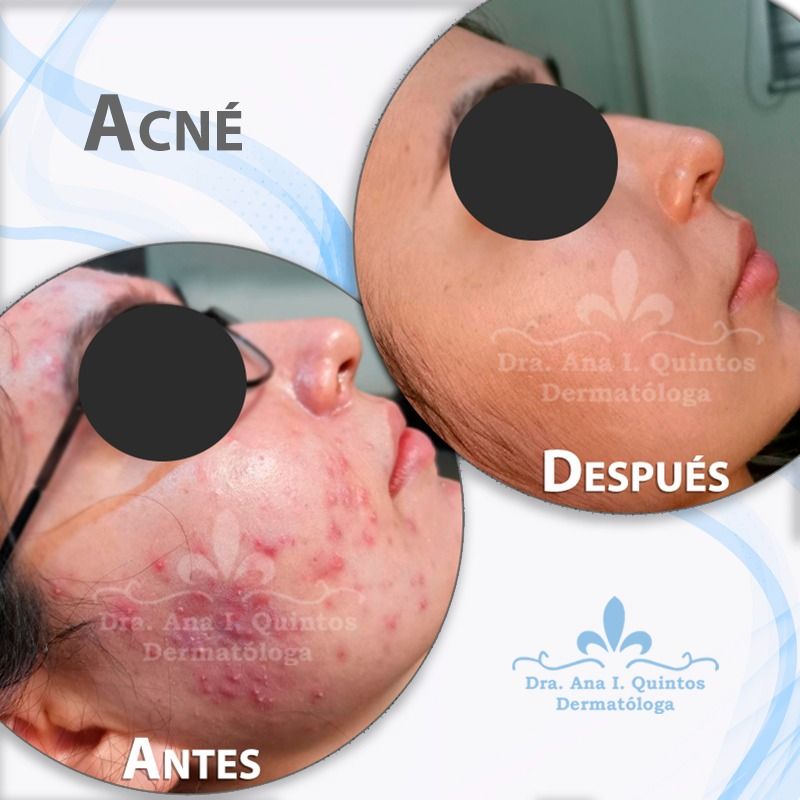 Dra. Ana Quintos - DERMATOLOGA