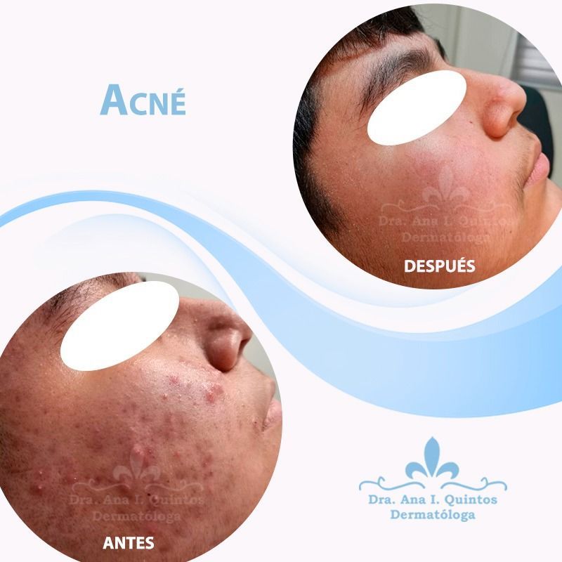 Dra. Ana Quintos - DERMATOLOGA
