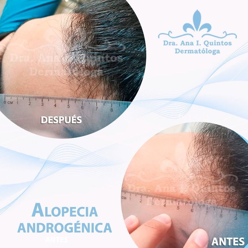 Dra. Ana Quintos - DERMATOLOGA