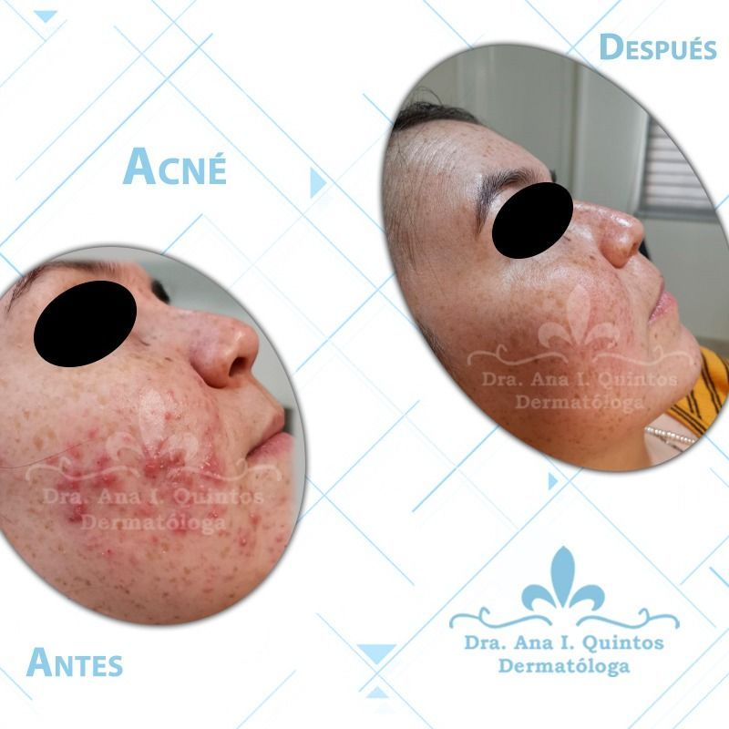 Dra. Ana Quintos - DERMATOLOGA