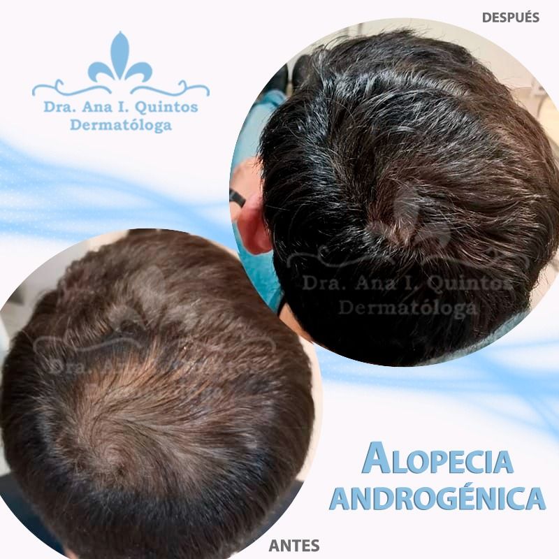 Dra. Ana Quintos - DERMATOLOGA