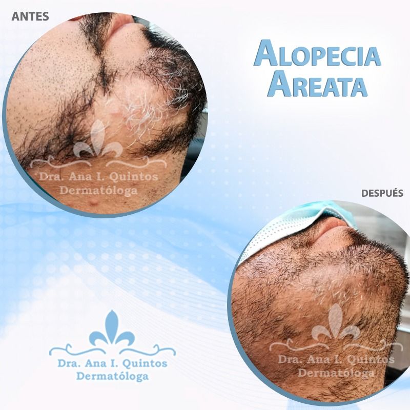 Dra. Ana Quintos - DERMATOLOGA
