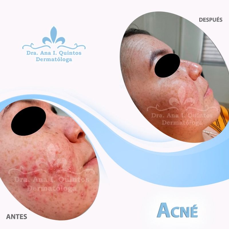 Dra. Ana Quintos - DERMATOLOGA