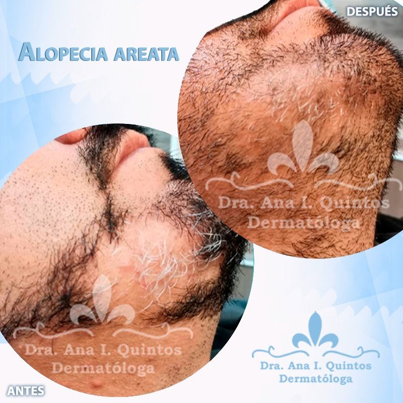 Dra. Ana Quintos - DERMATOLOGA