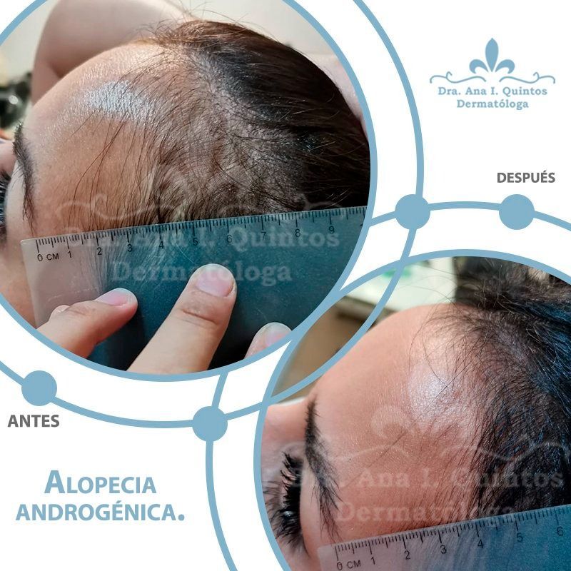 Dra. Ana Quintos - DERMATOLOGA