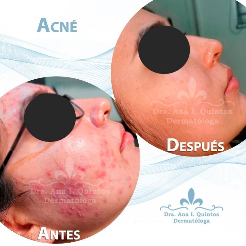 Dra. Ana Quintos - DERMATOLOGA