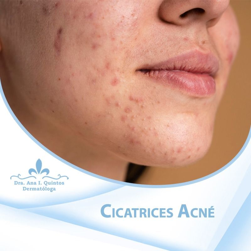 Dra. Ana Quintos - DERMATOLOGA