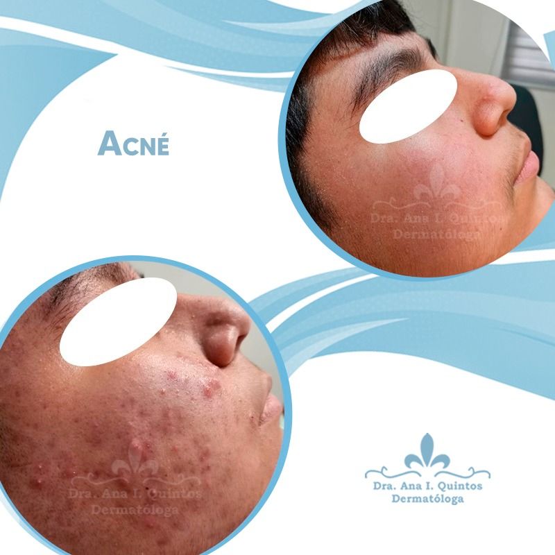 Dra. Ana Quintos - DERMATOLOGA