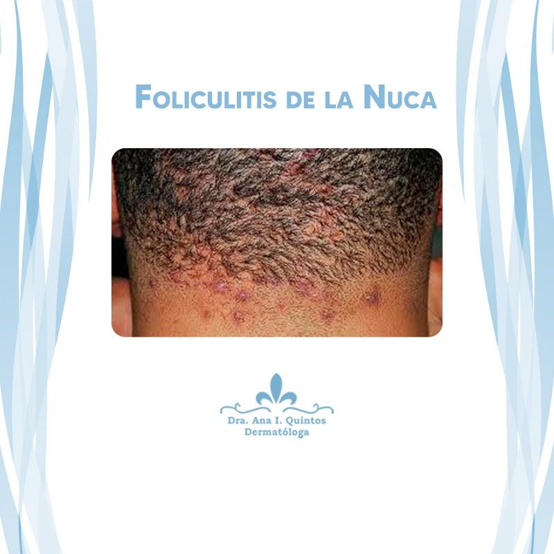 Dra. Ana Quintos - DERMATOLOGA