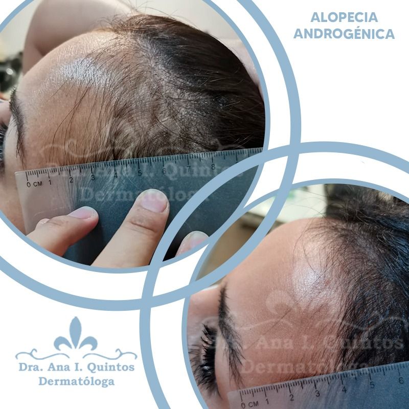 Dra. Ana Quintos - DERMATOLOGA