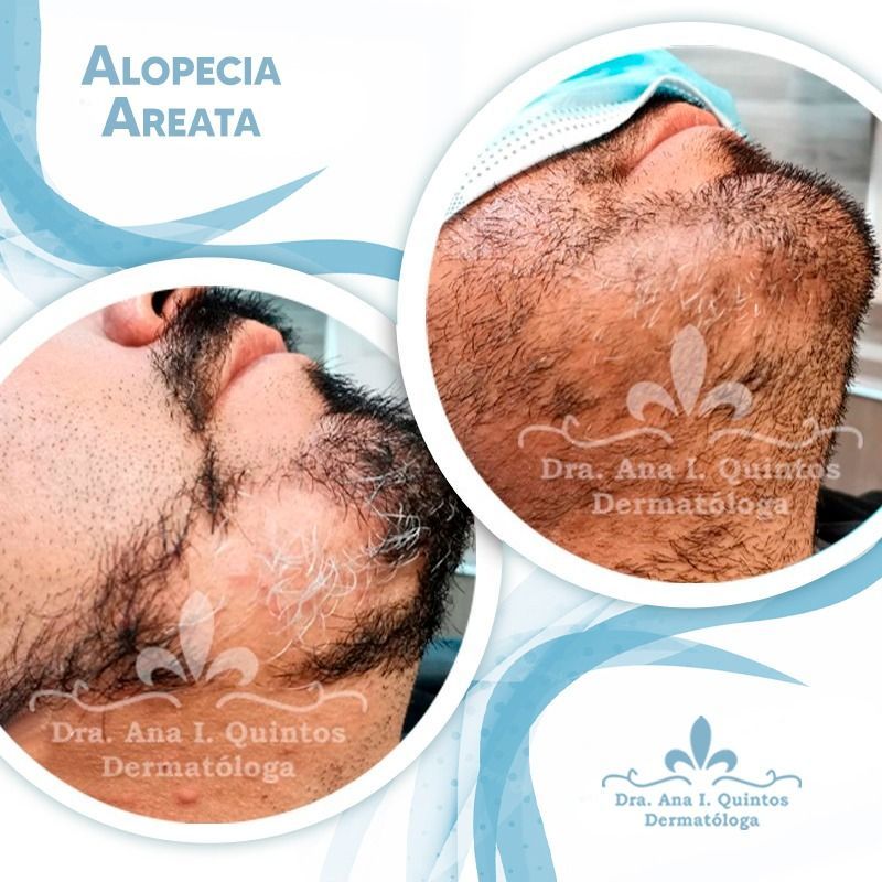 Dra. Ana Quintos - DERMATOLOGA