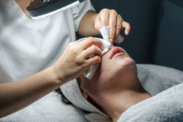TRATAMIENTOS CONTRA EL ACNE