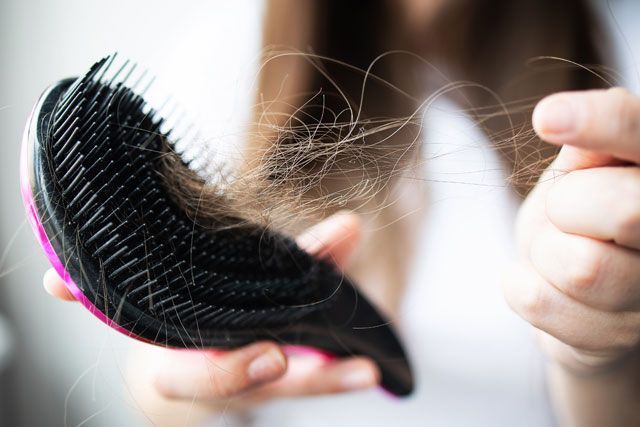 ALOPECIA