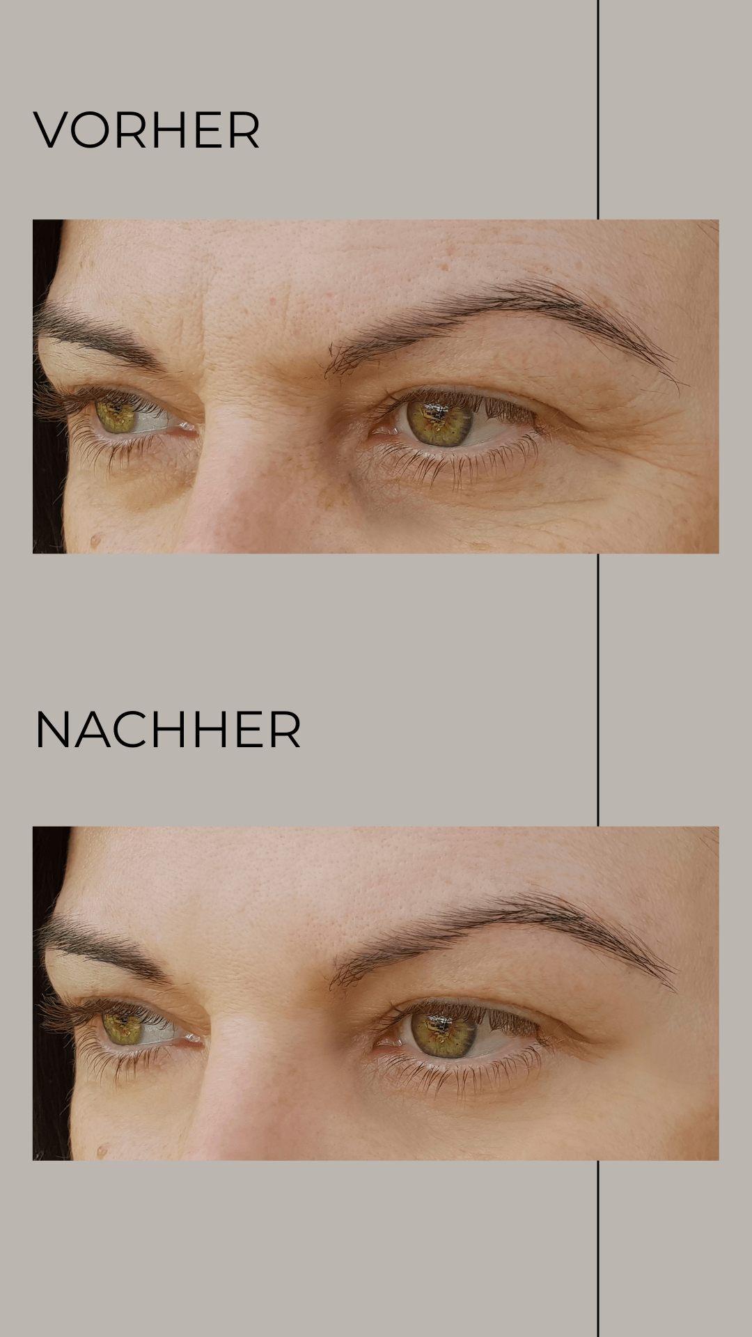 Ein Vorher-Nachher-Bild der Augenbrauen einer Frau.