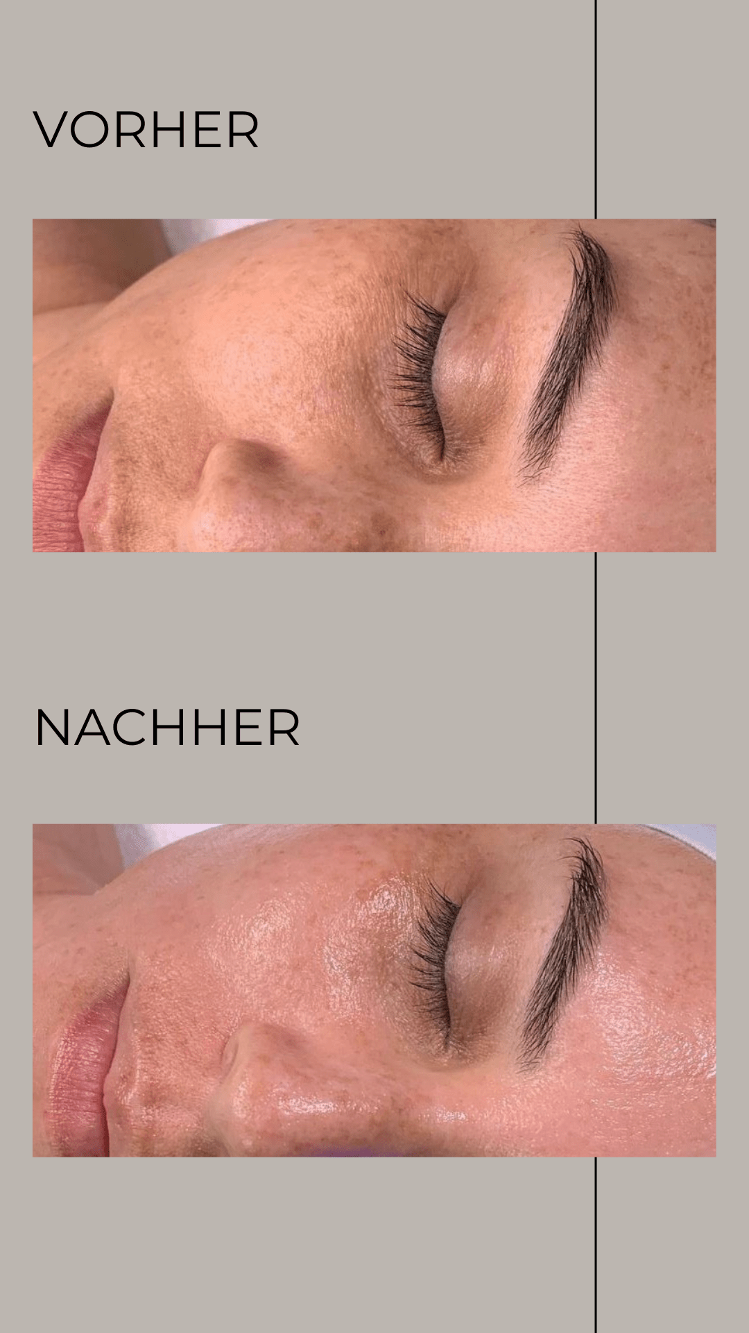 Ein Vorher-Nachher-Bild des Gesichts einer Frau mit geschlossenen Augen.