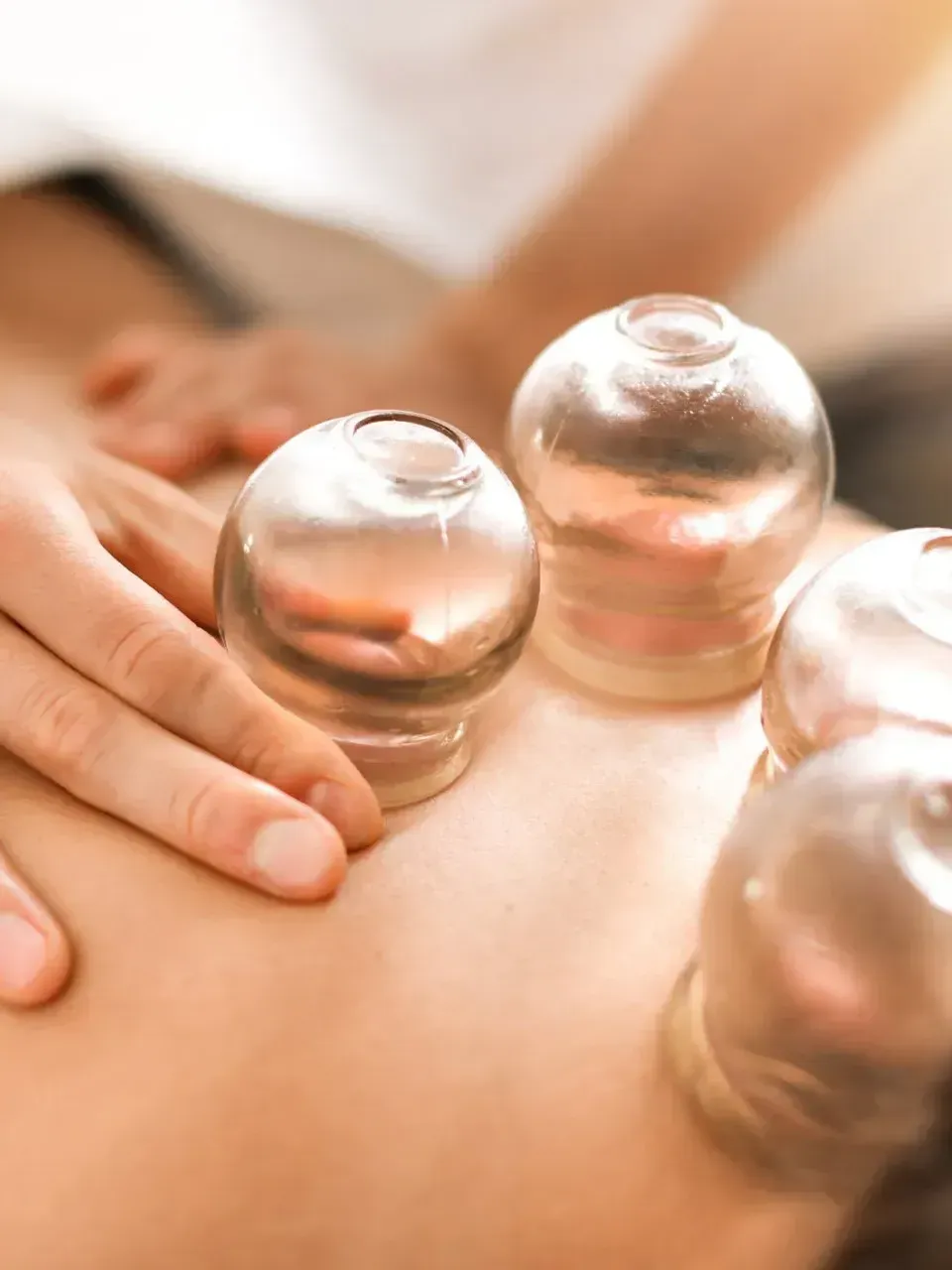 a person is getting a cupping treatment on their back