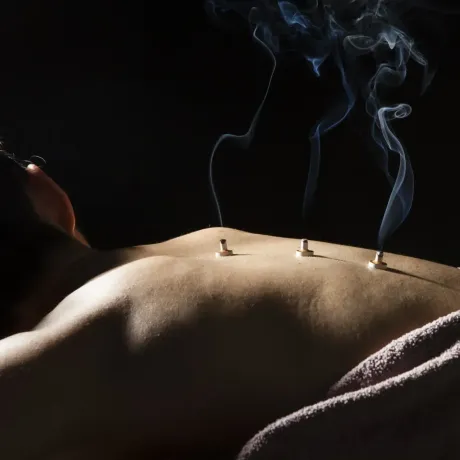 a person getting moxibustion treatment