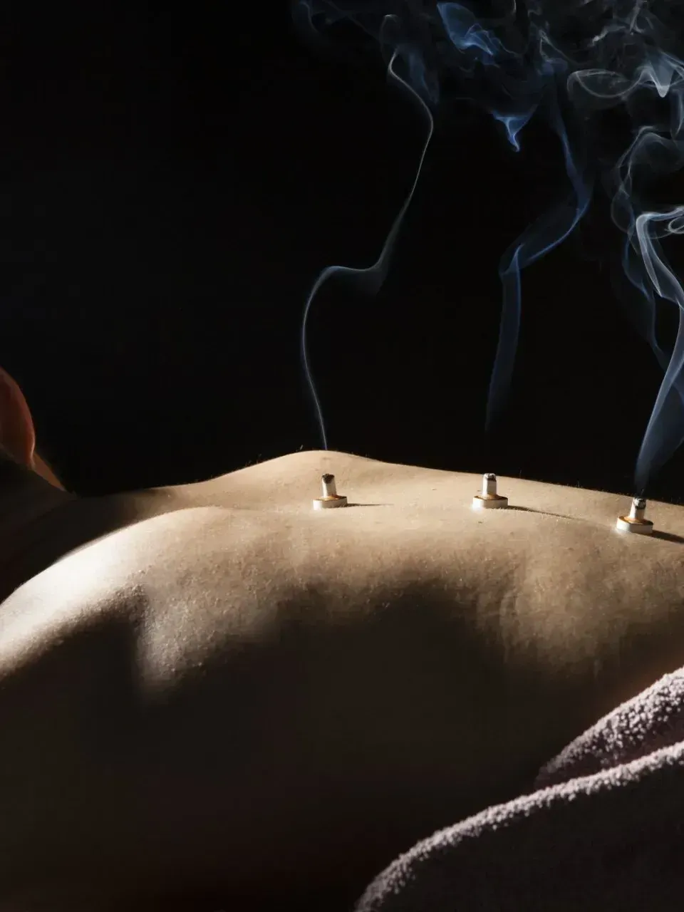 A person getting moxibustion at Chinese Medicine Centre