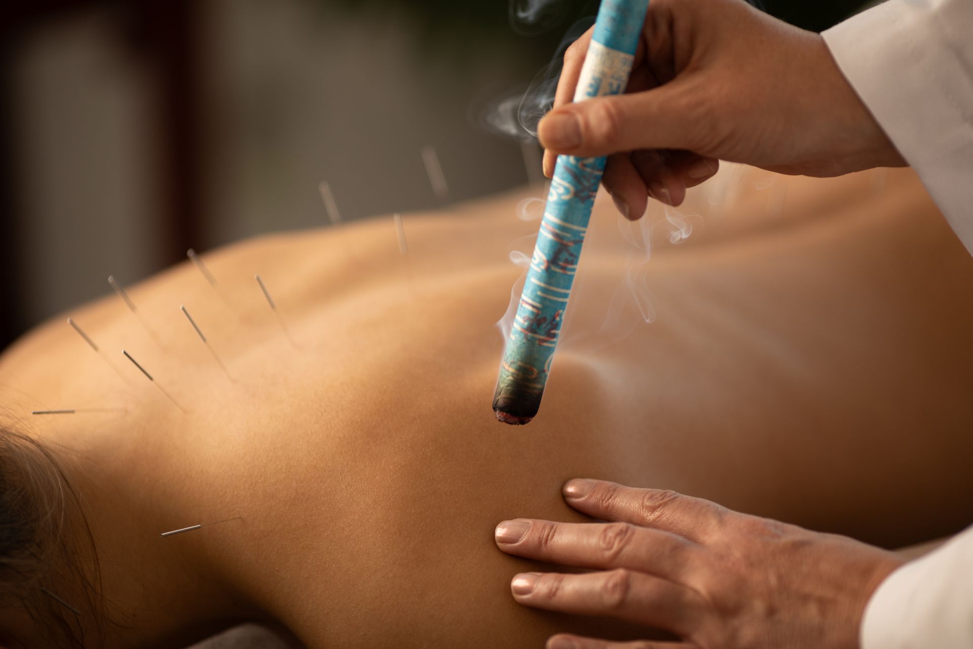 moxibustion process