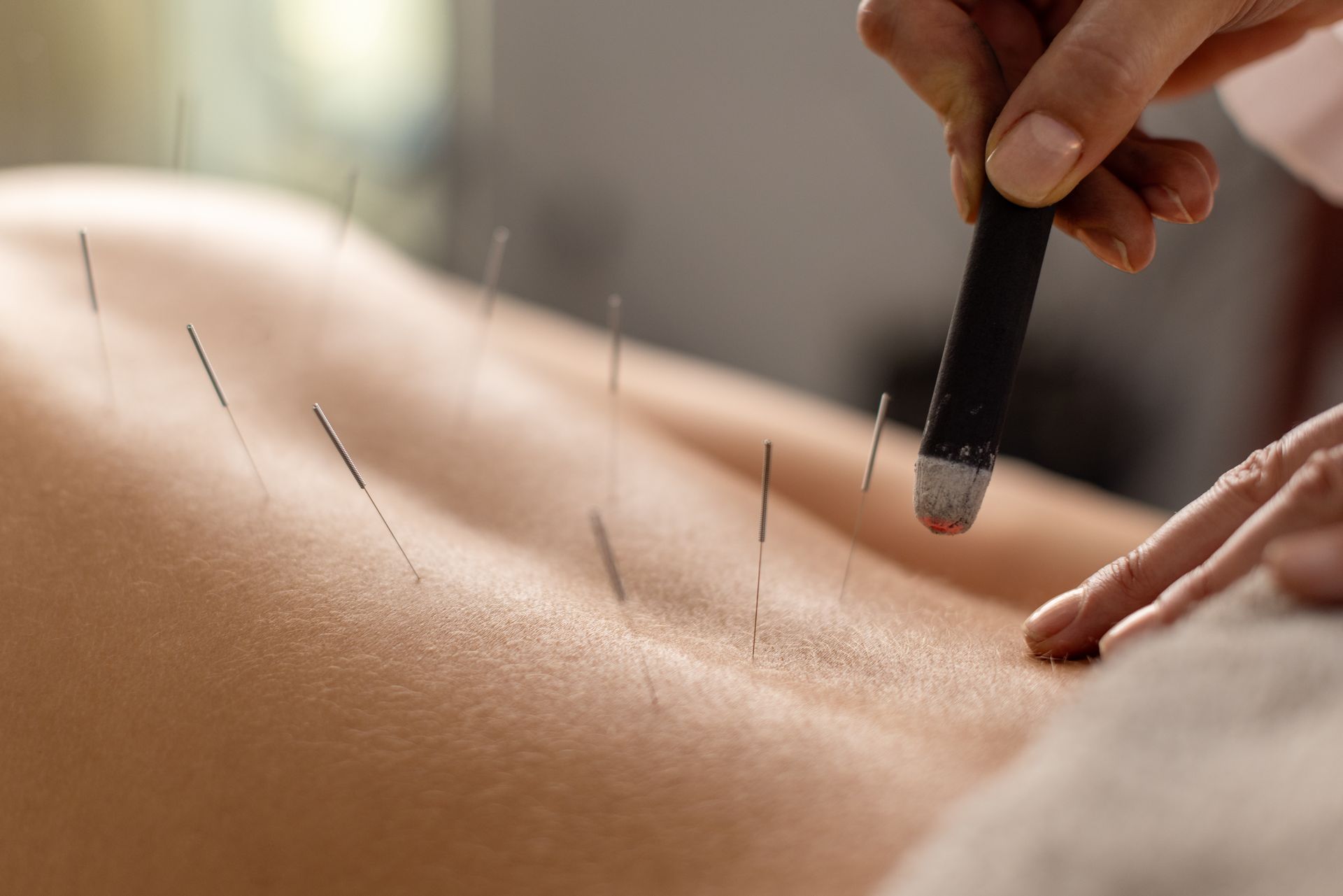 moxibustion therapy