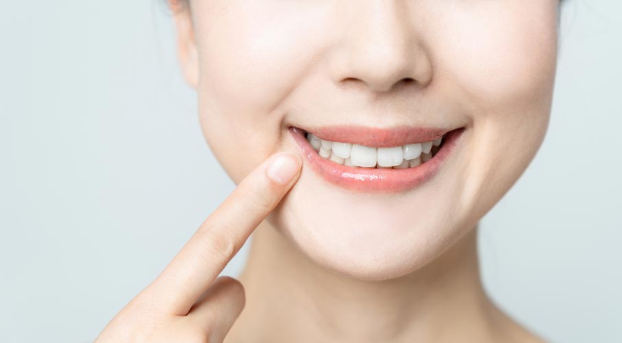 Cosmetic Dental Treatment Smiling Woman Pointing At Teeth