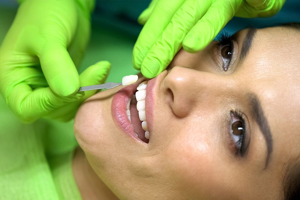 Dentist Matching Dental Shade To Teeth Wearing Green Gloves
