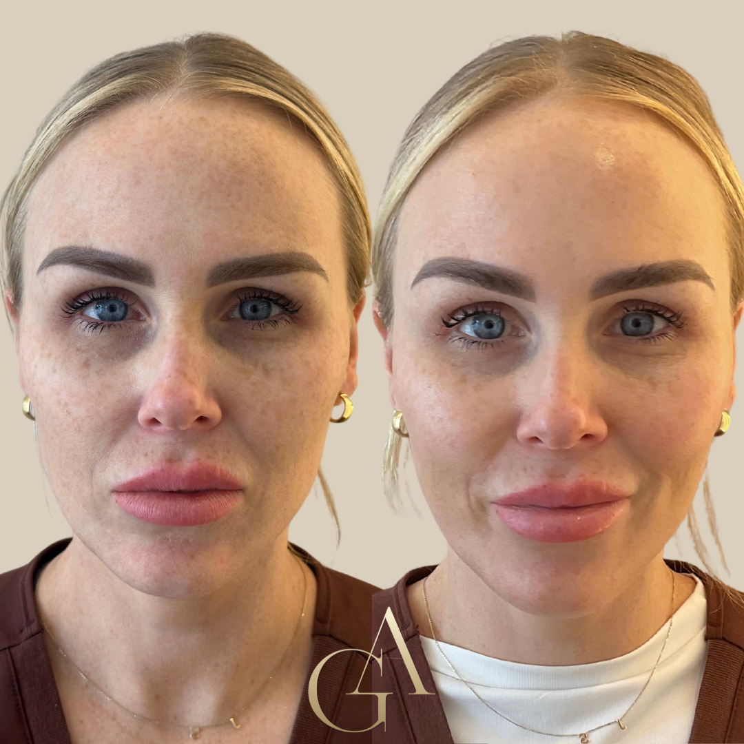 A before and after photo of a woman 's face.