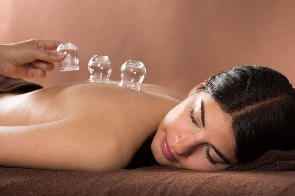 Person Receiving Cupping Therapy on Their Back — Leela Thai Massage & Spa in Newtown, QLD