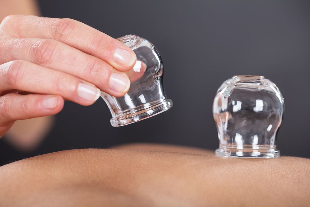 Person's Back With Two Glass Cups Placed on It — Leela Thai Massage & Spa in Newtown, QLD