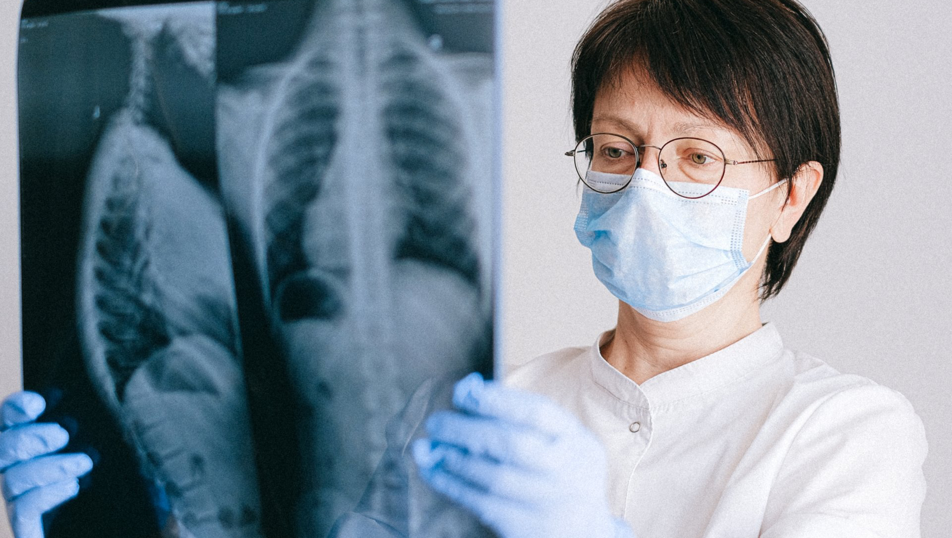 Doctor examining lung X-ray; wearing a mask, glasses, and gloves, in a medical setting.