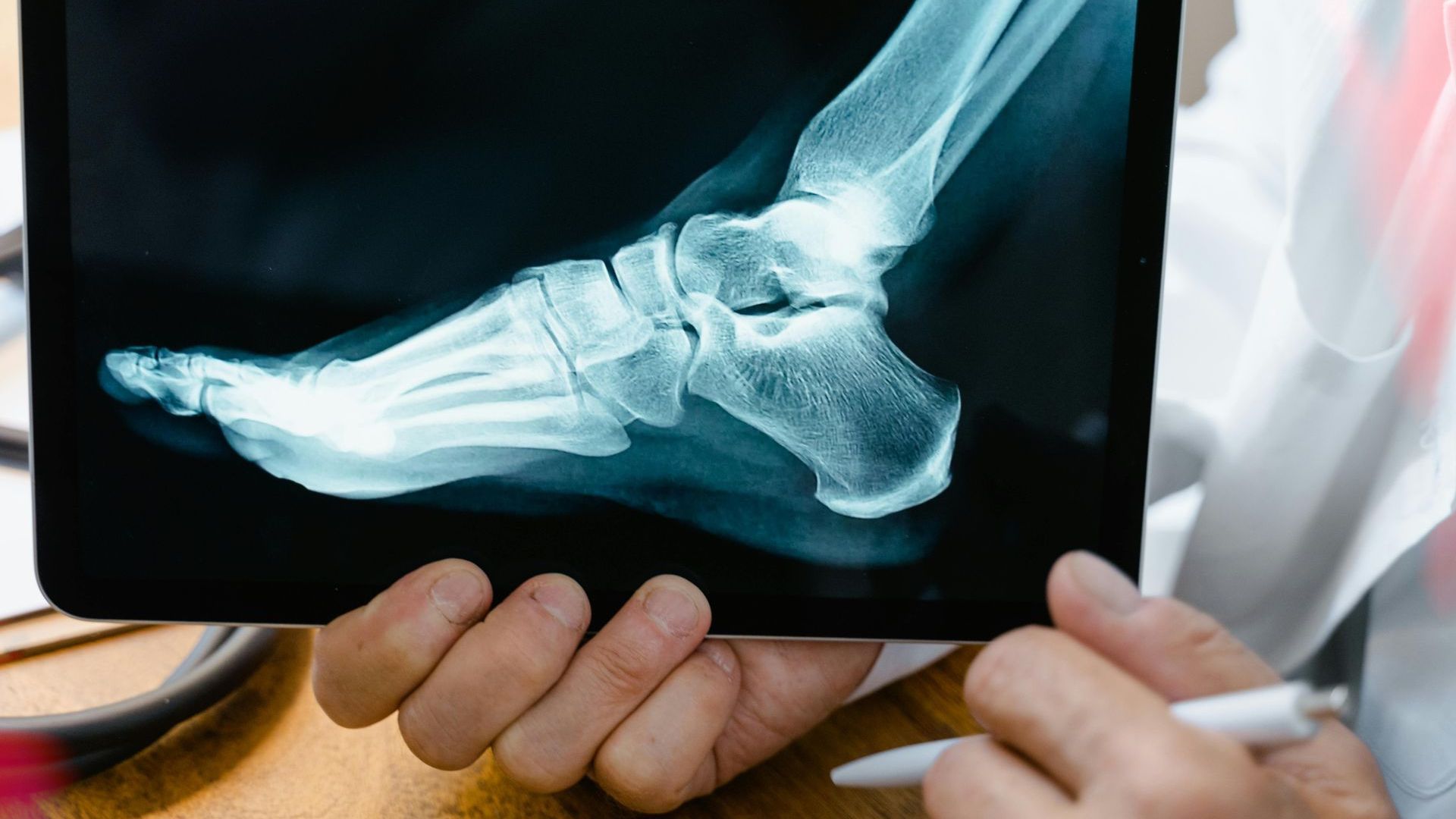 Doctor pointing to foot X-ray on a tablet. Blue and white bones visible, close-up.