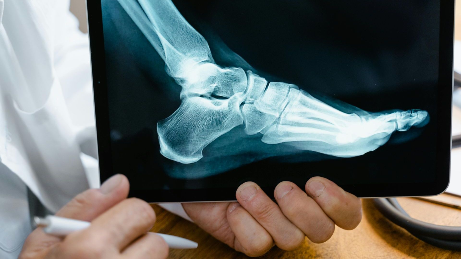 Doctor holding a digital X-ray of a foot, pointing at the image with a pen.