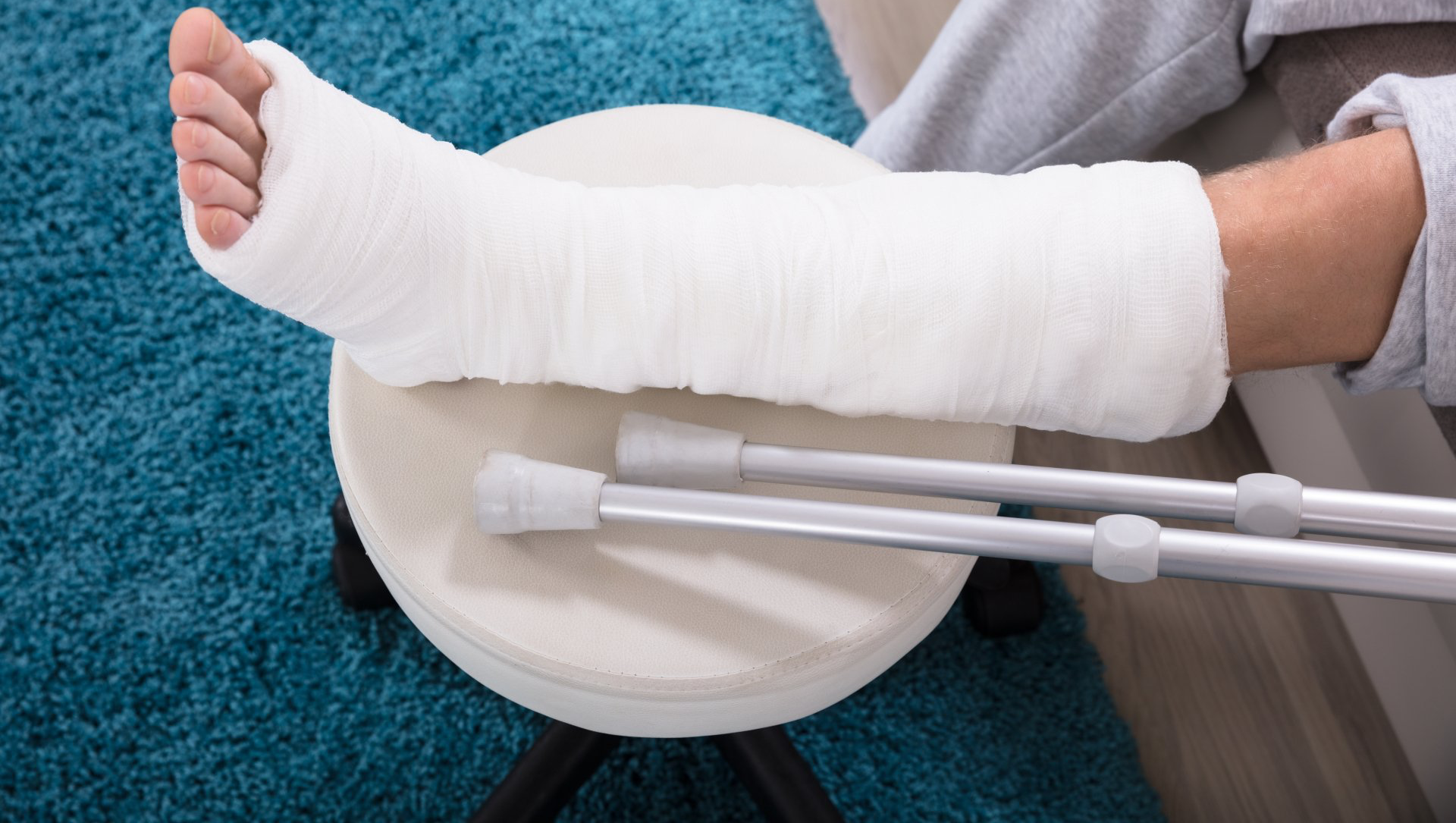 Foot in white cast on stool with crutches.