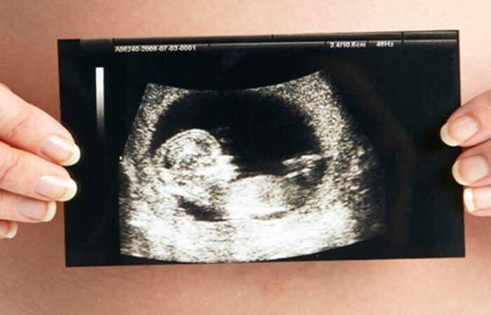 DRA. AÍDA DEL C. ESCALANTE M - GINECOLOGÍA, OBSTETRICIA Y ULTRASONIDO