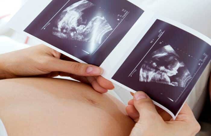 DRA. AÍDA DEL C. ESCALANTE M - GINECOLOGÍA, OBSTETRICIA Y ULTRASONIDO