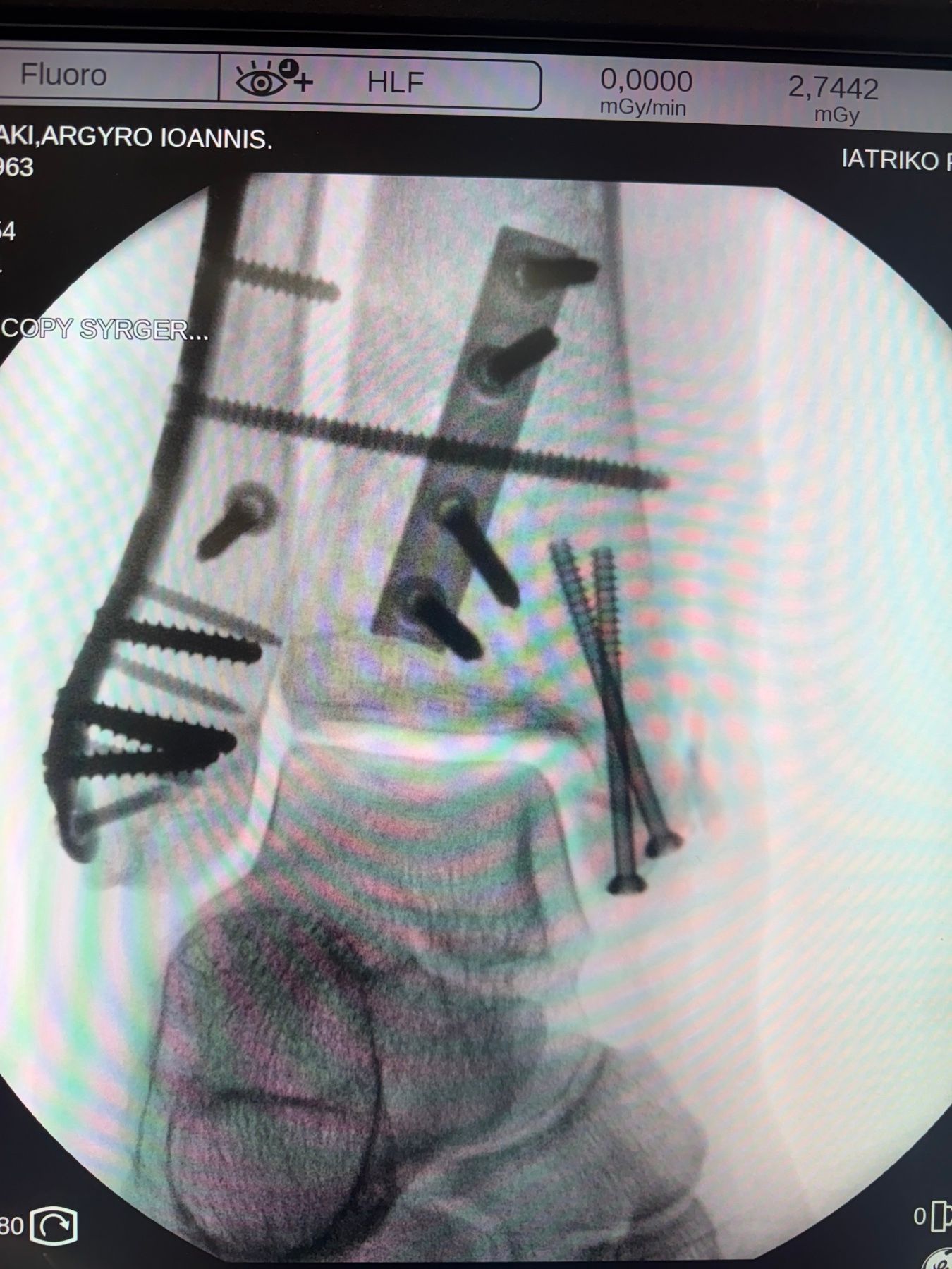 Post-operative image 2