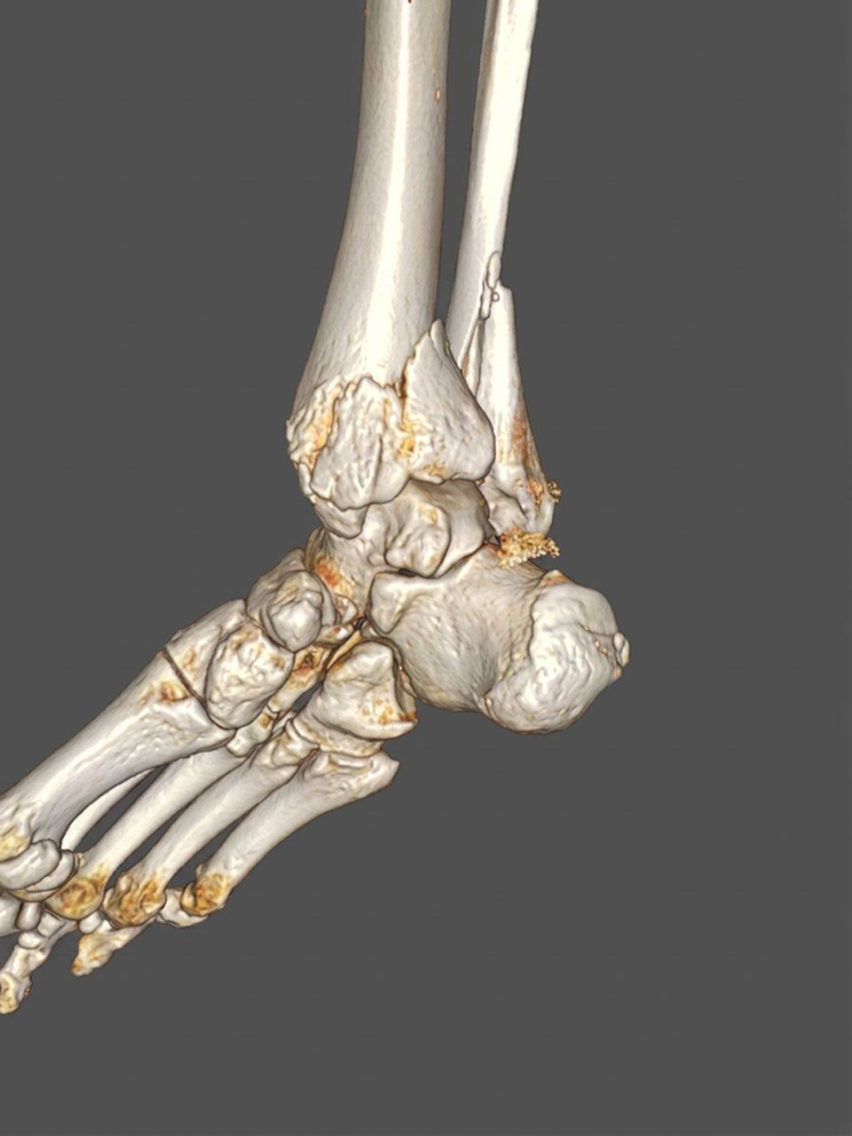 Pre-operative image 1