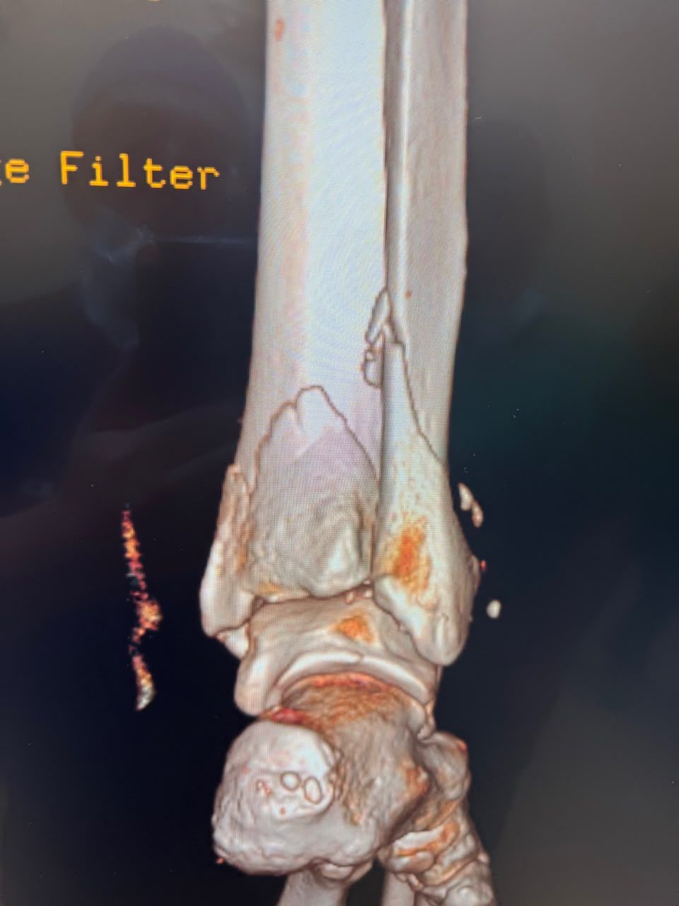Pre-operative image 12