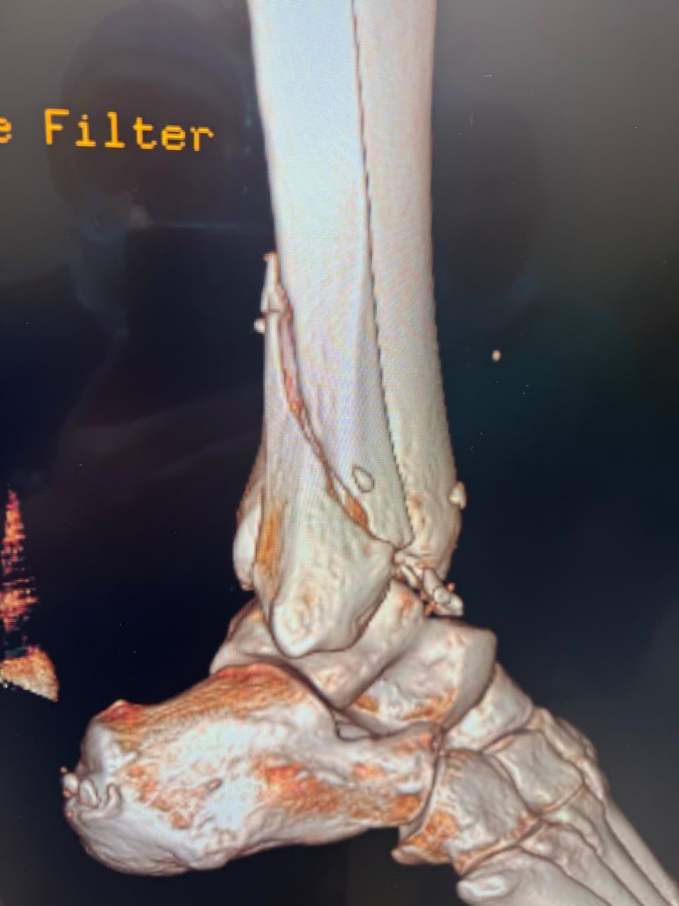 Pre-operative image 13