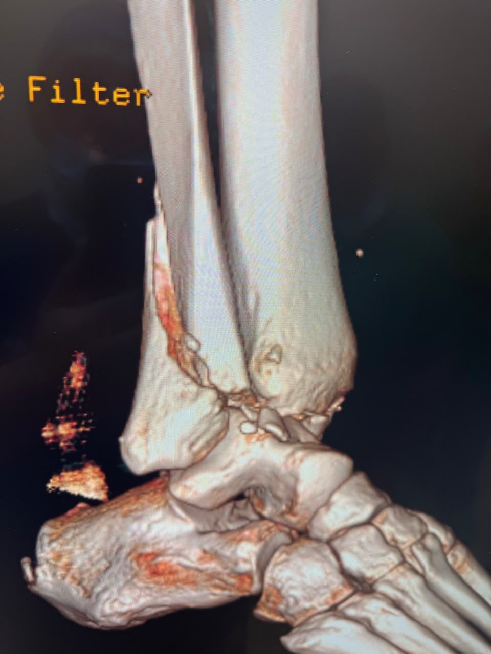 Pre-operative image 14