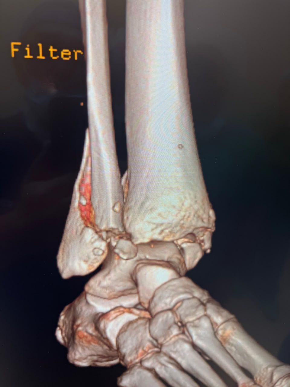 Pre-operative image 15