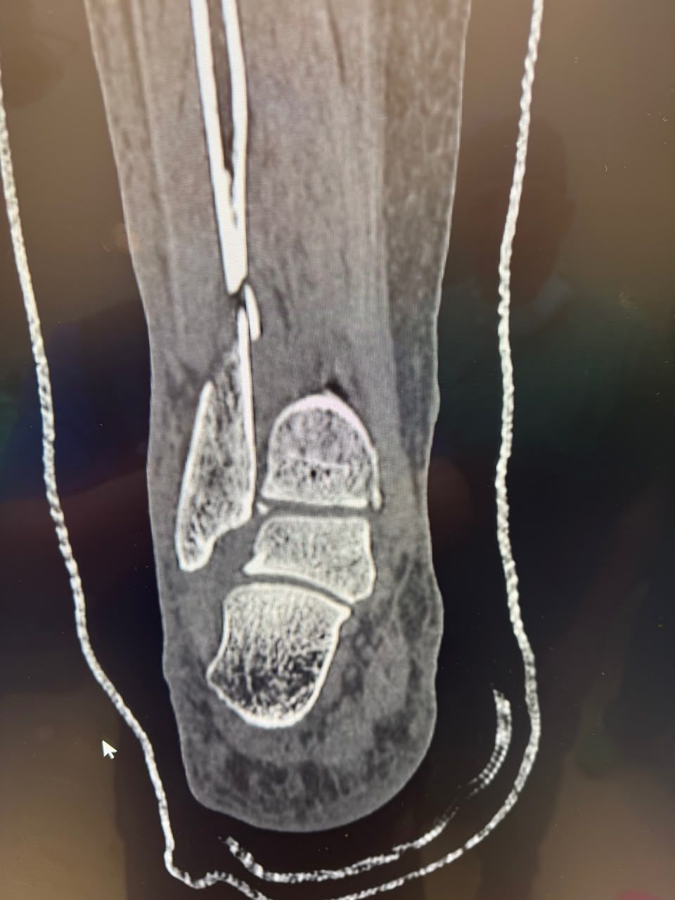 Pre-operative image 16