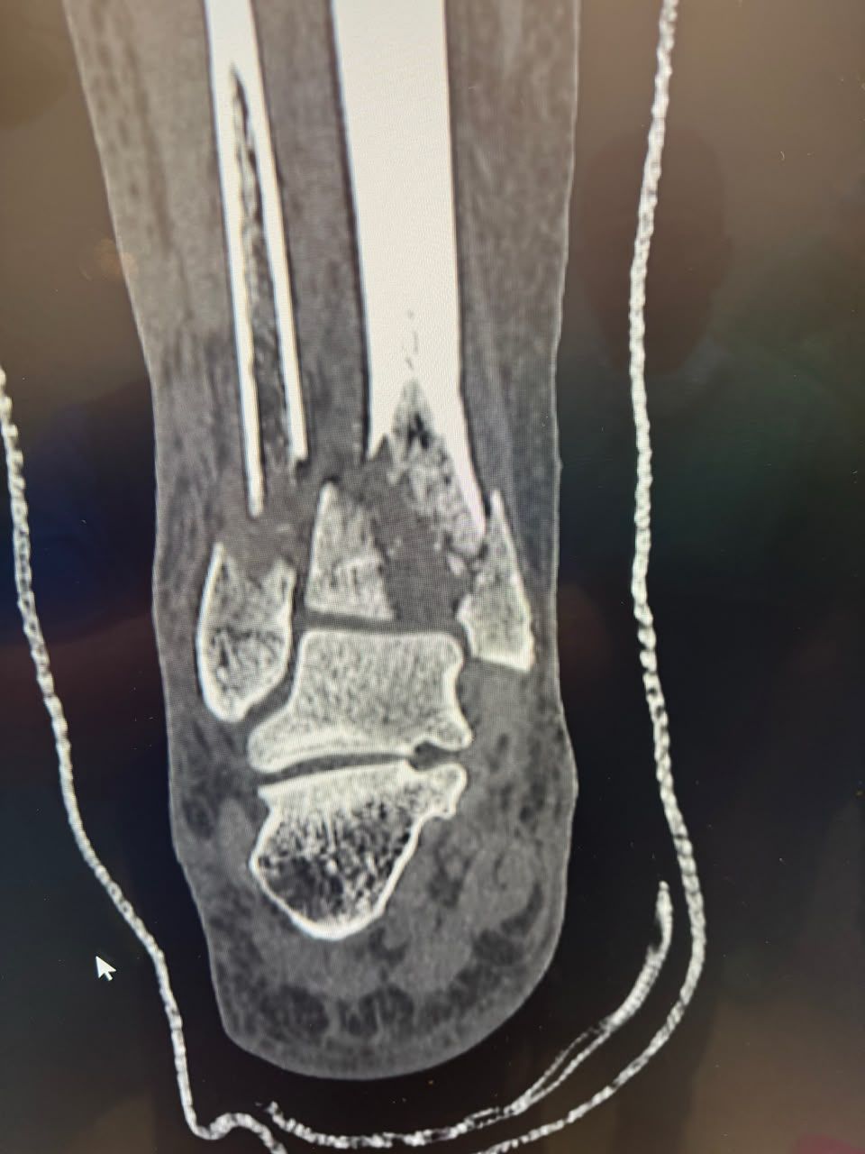 Pre-operative image 17
