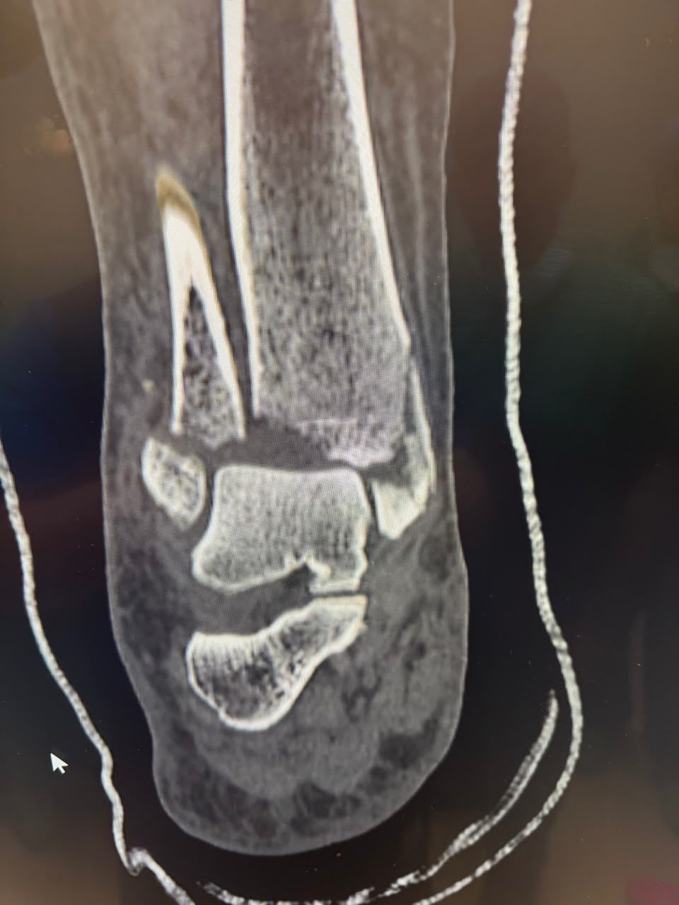 Pre-operative image 18
