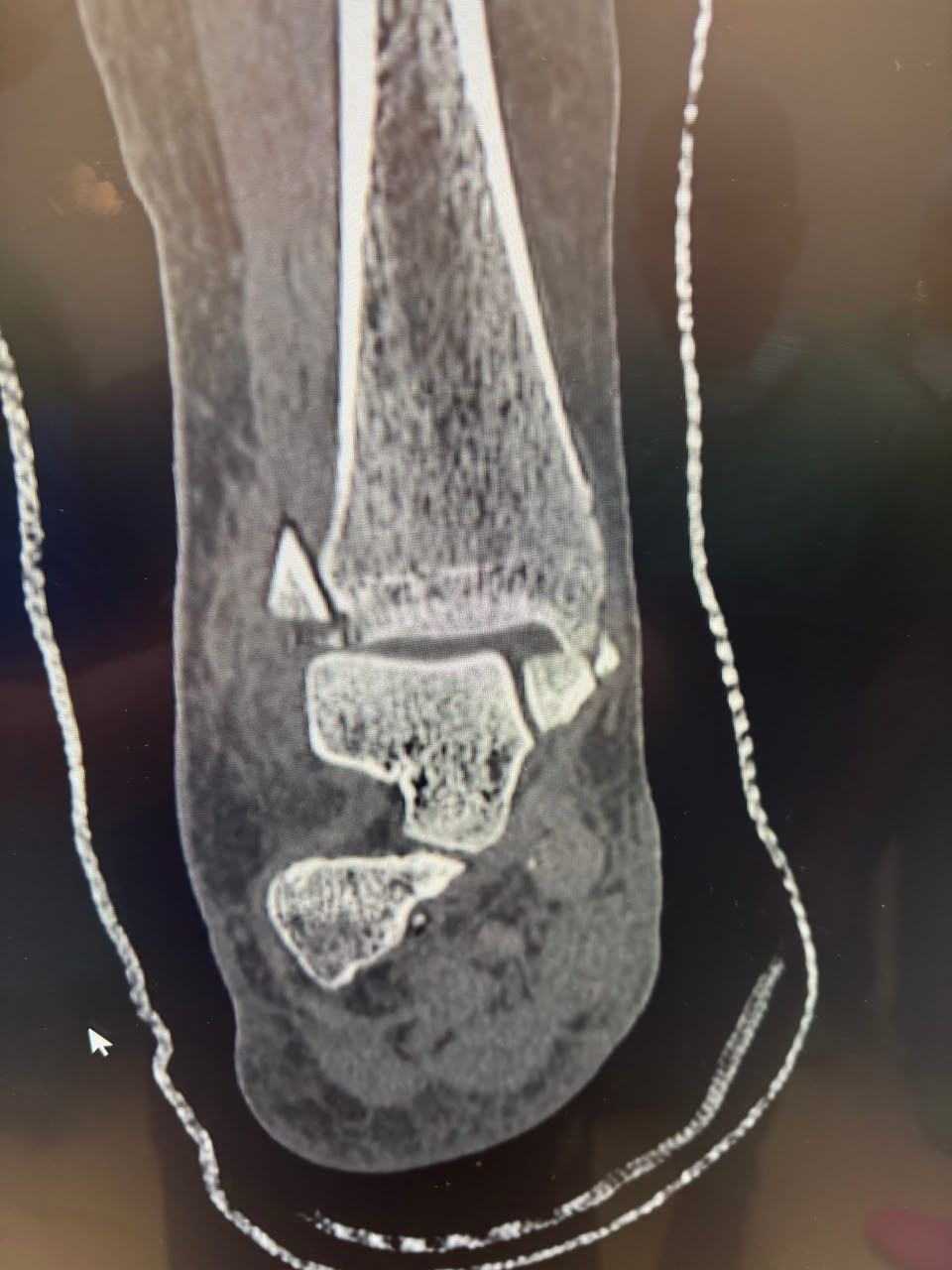 Pre-operative image 19