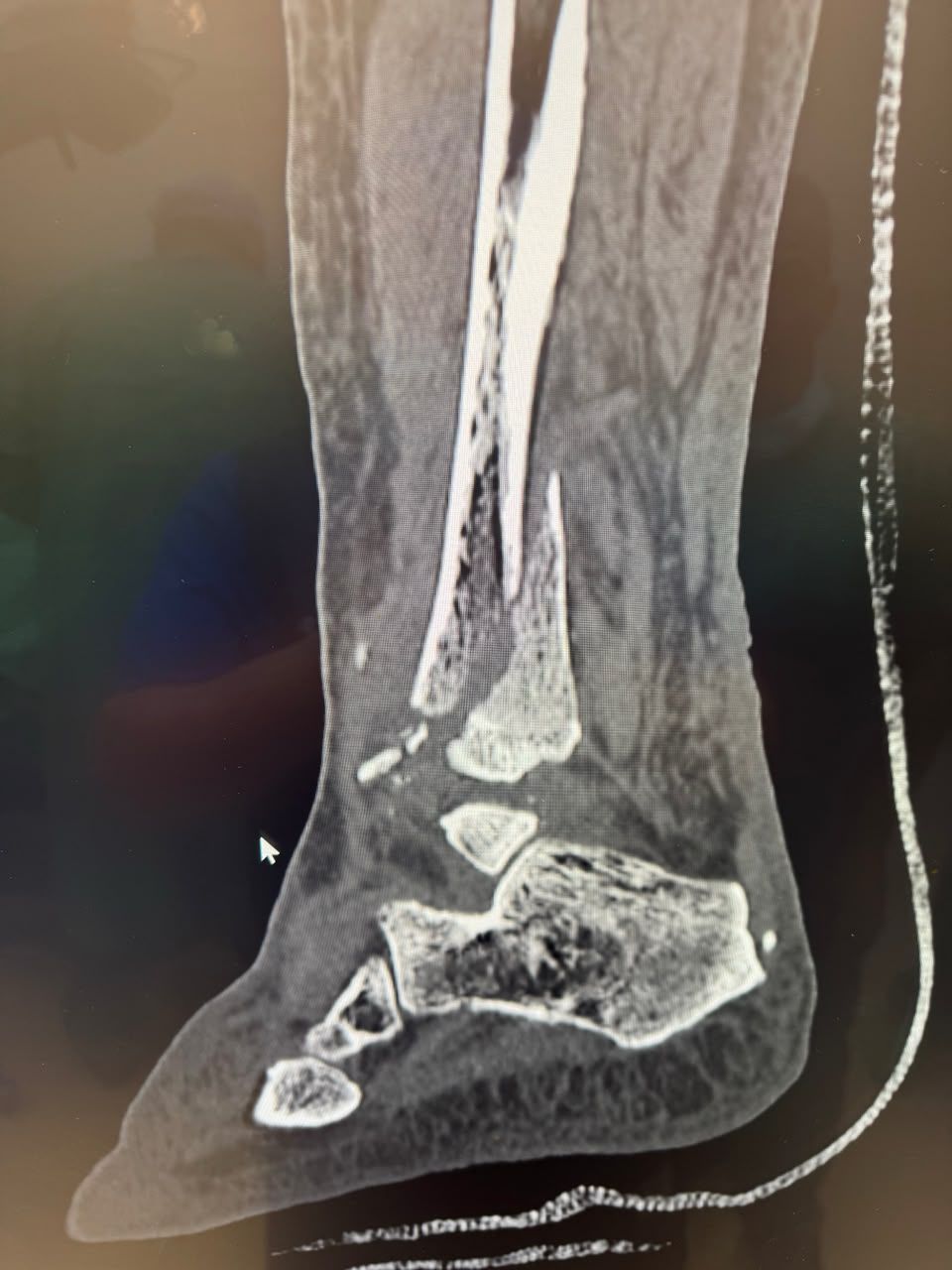 Pre-operative image 20
