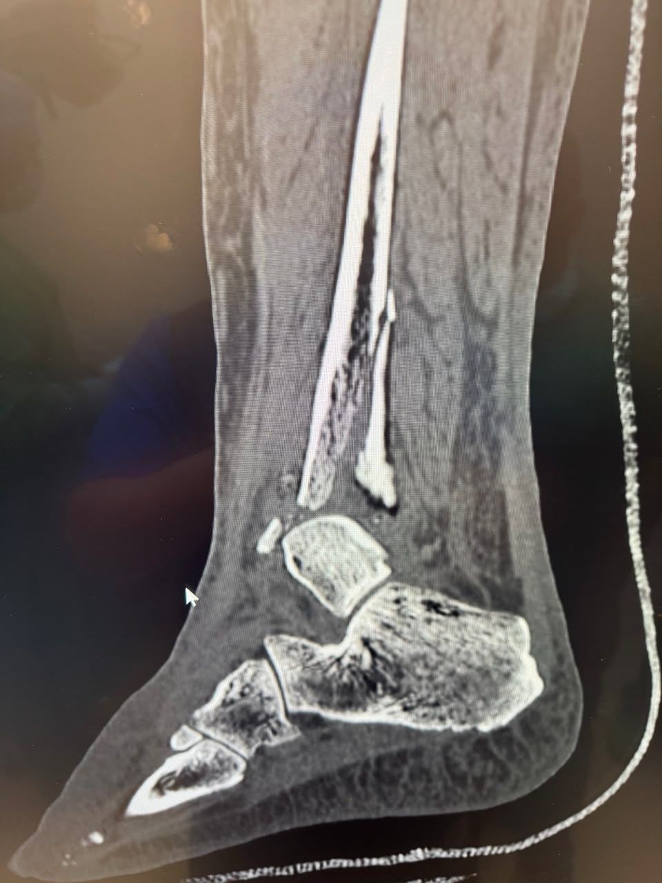 Pre-operative image 21